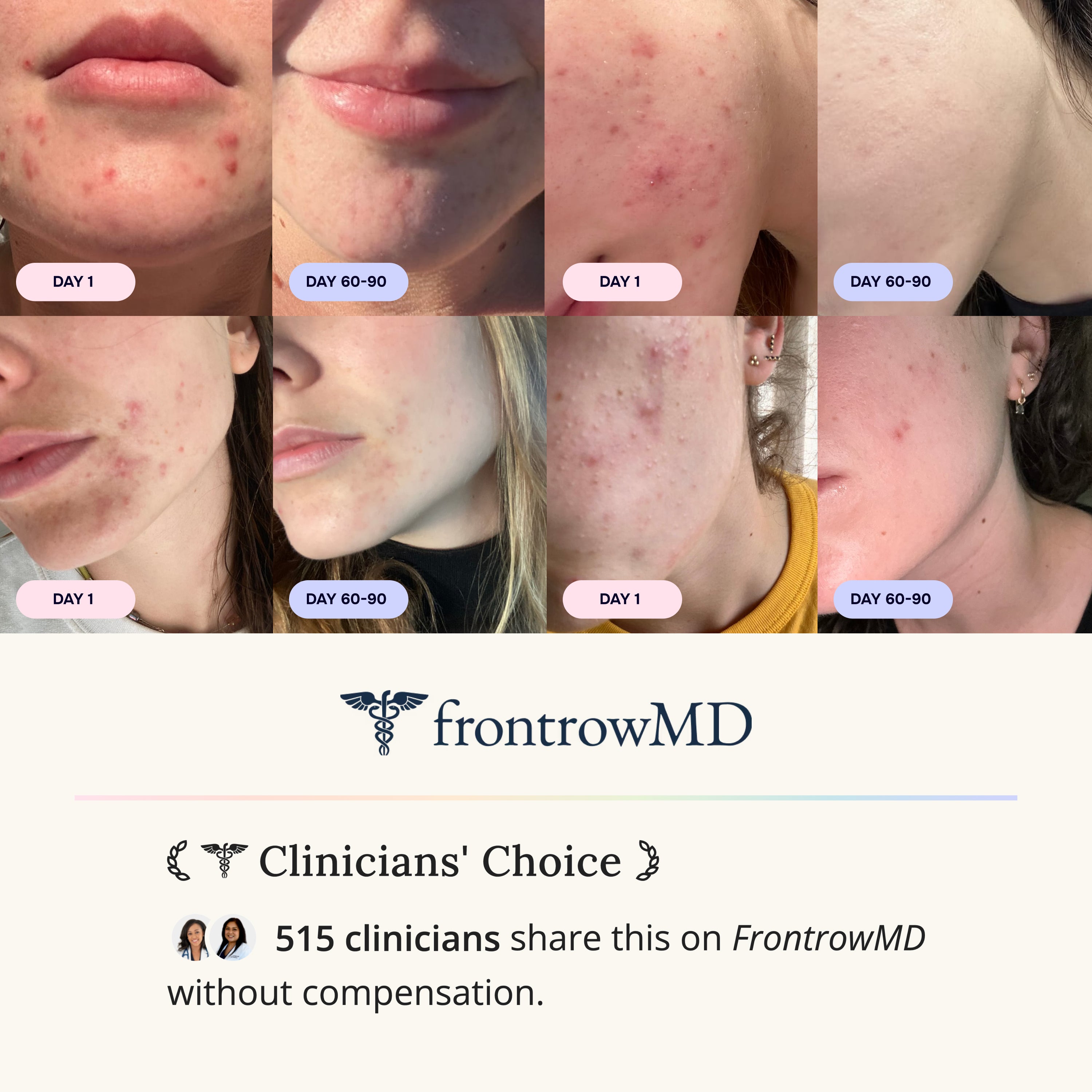 Skin & Gut Program™
