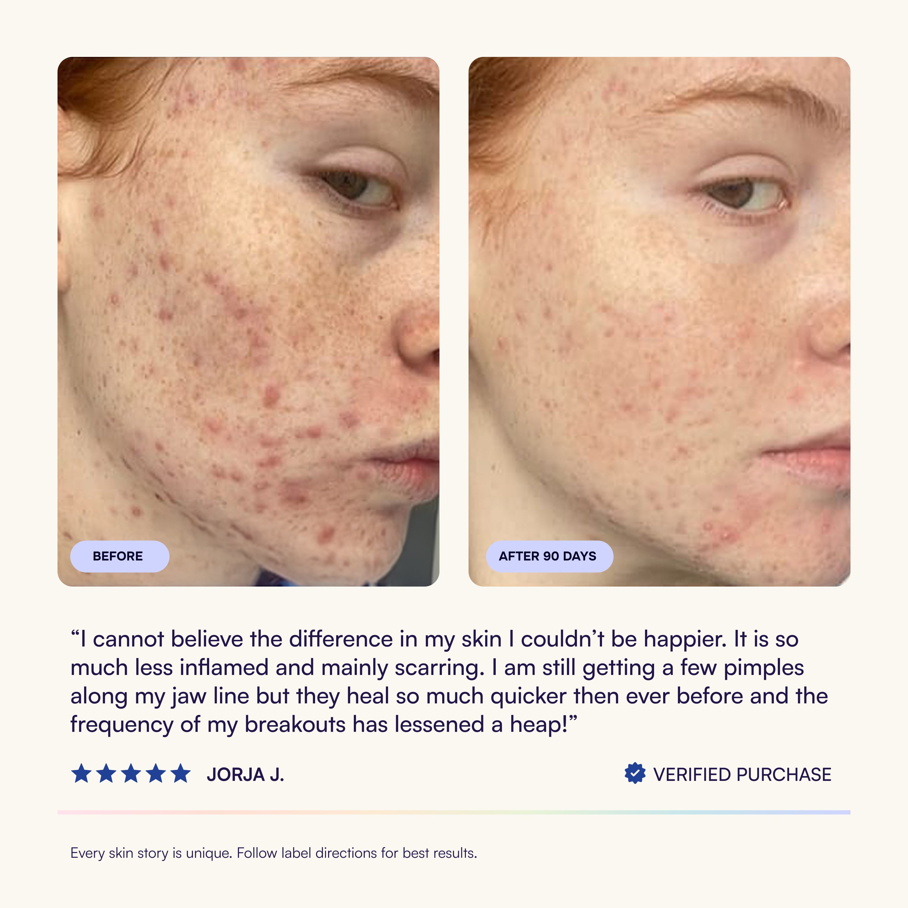 Skin & Gut Program™