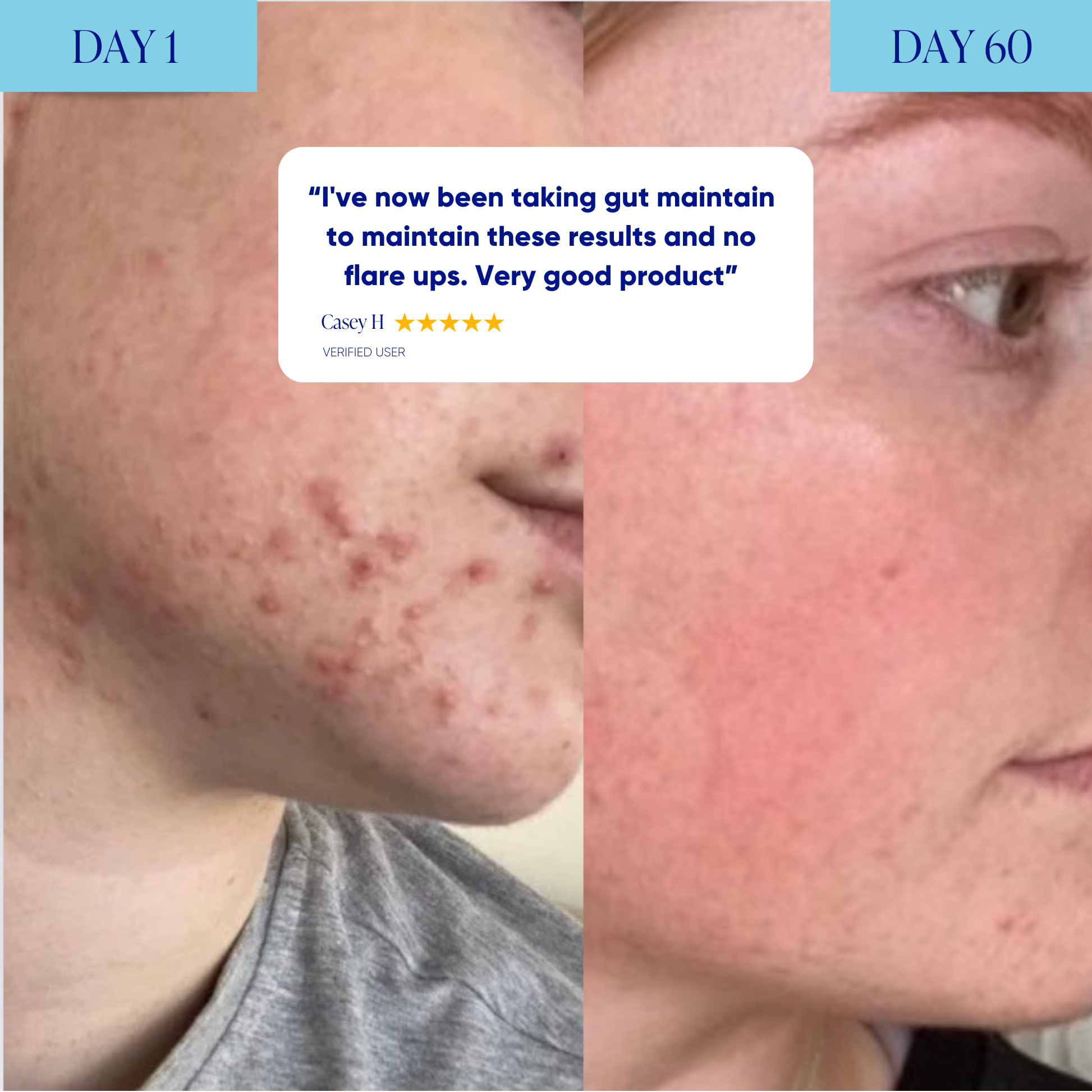 Skin & Gut Maintain™