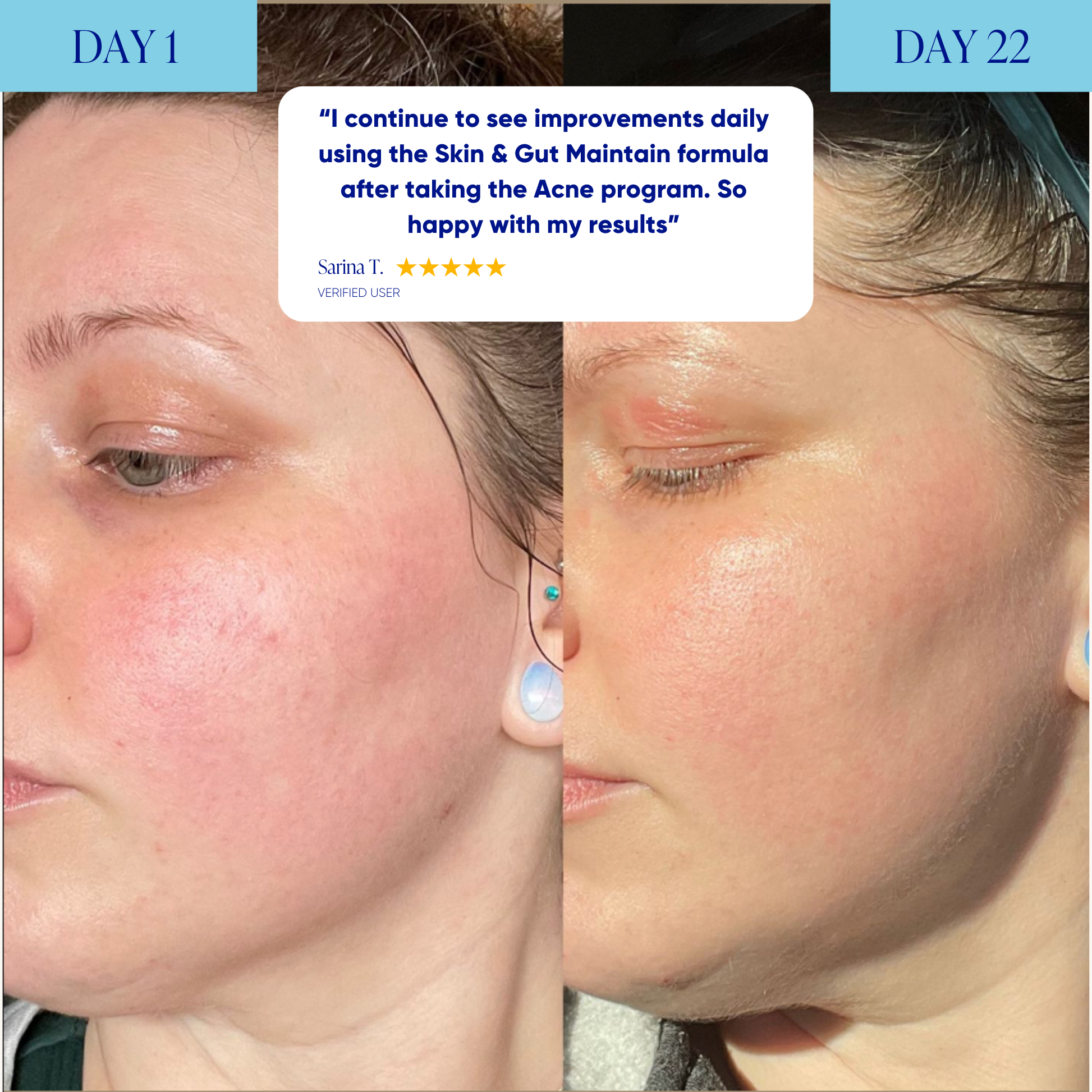 Skin & Gut Maintain™