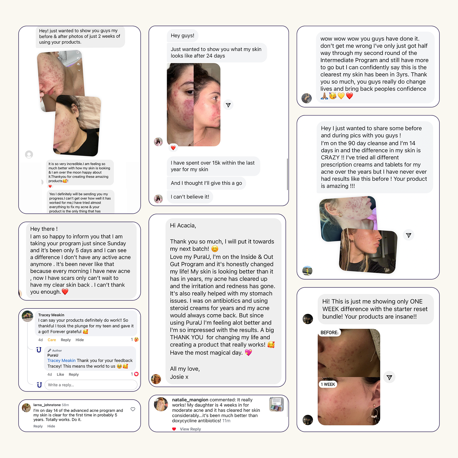 Advanced Acne Program™