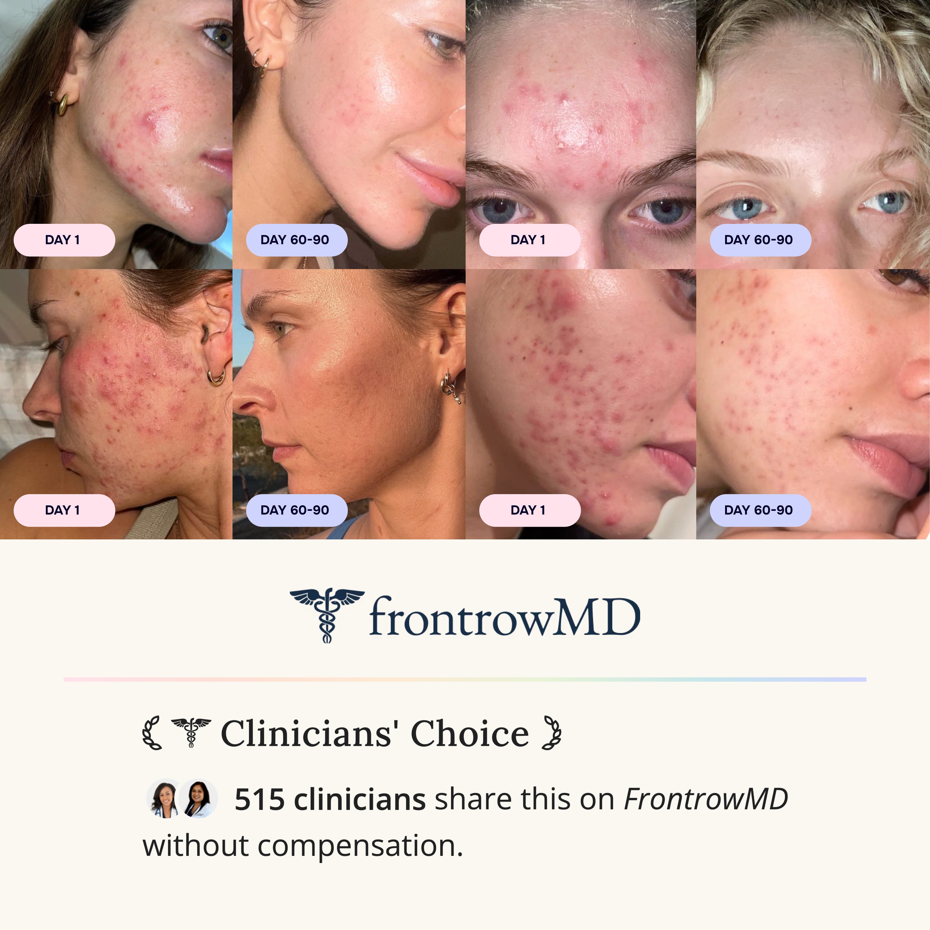 Skin & Gut Program™