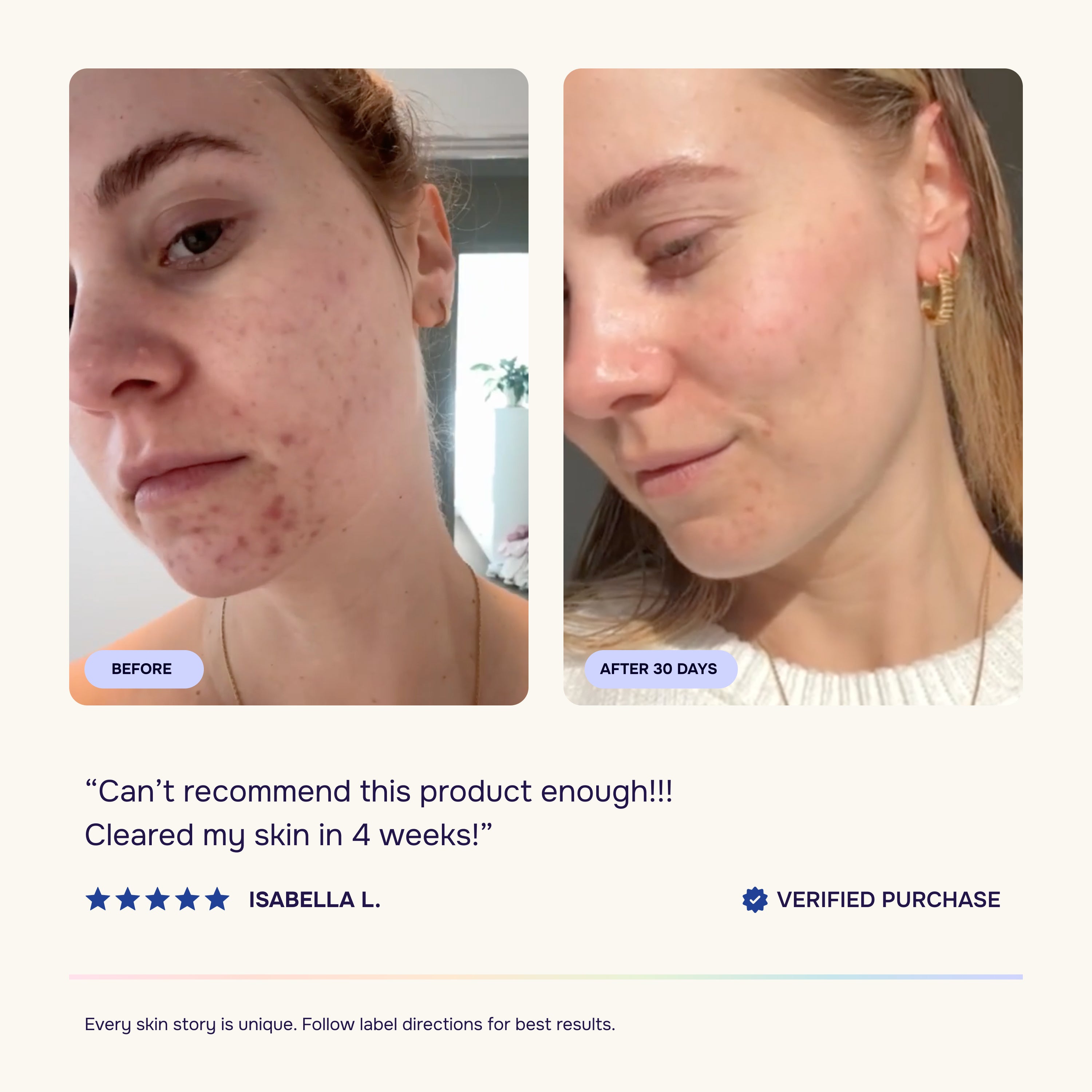 Skin & Gut Program™