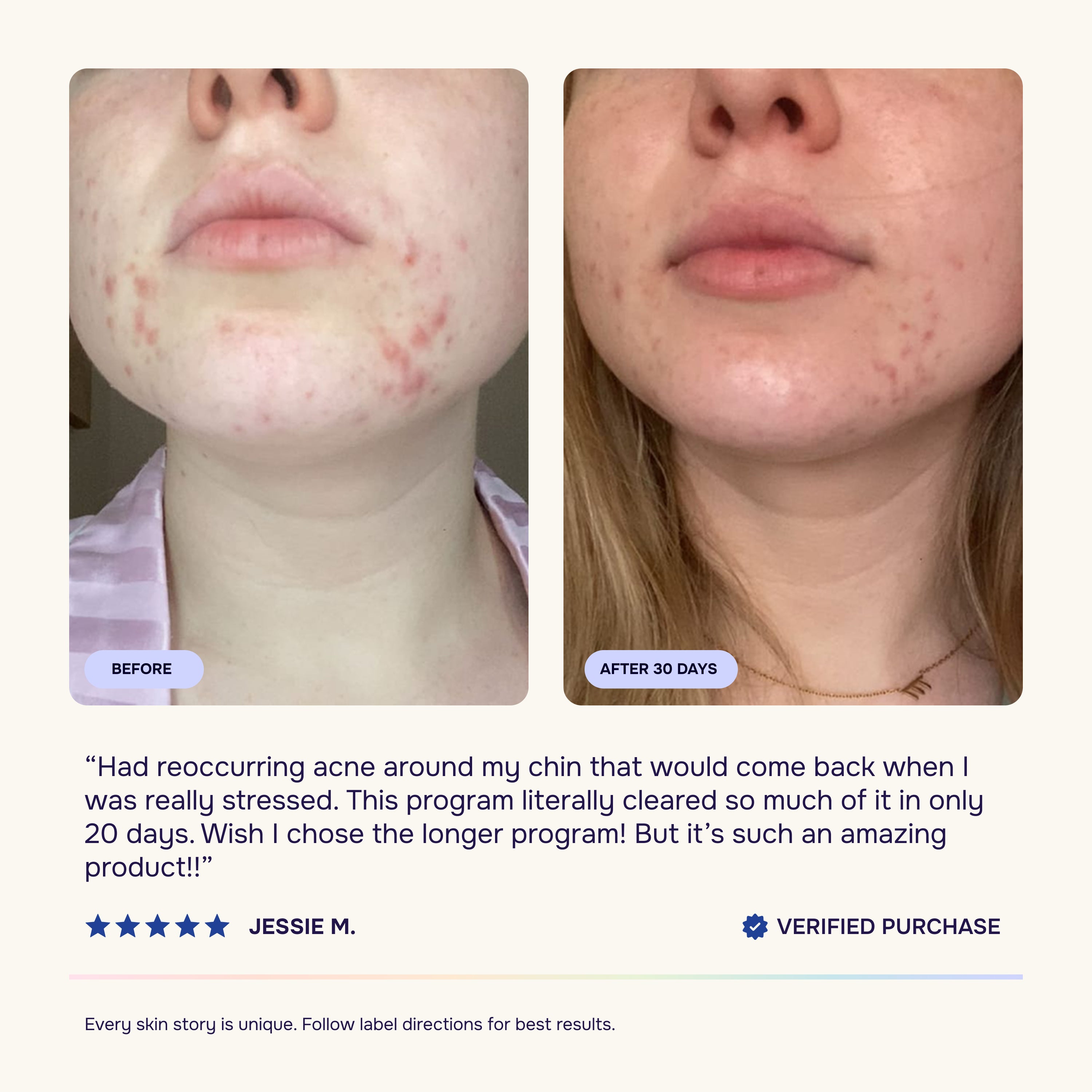 Skin & Gut Program™