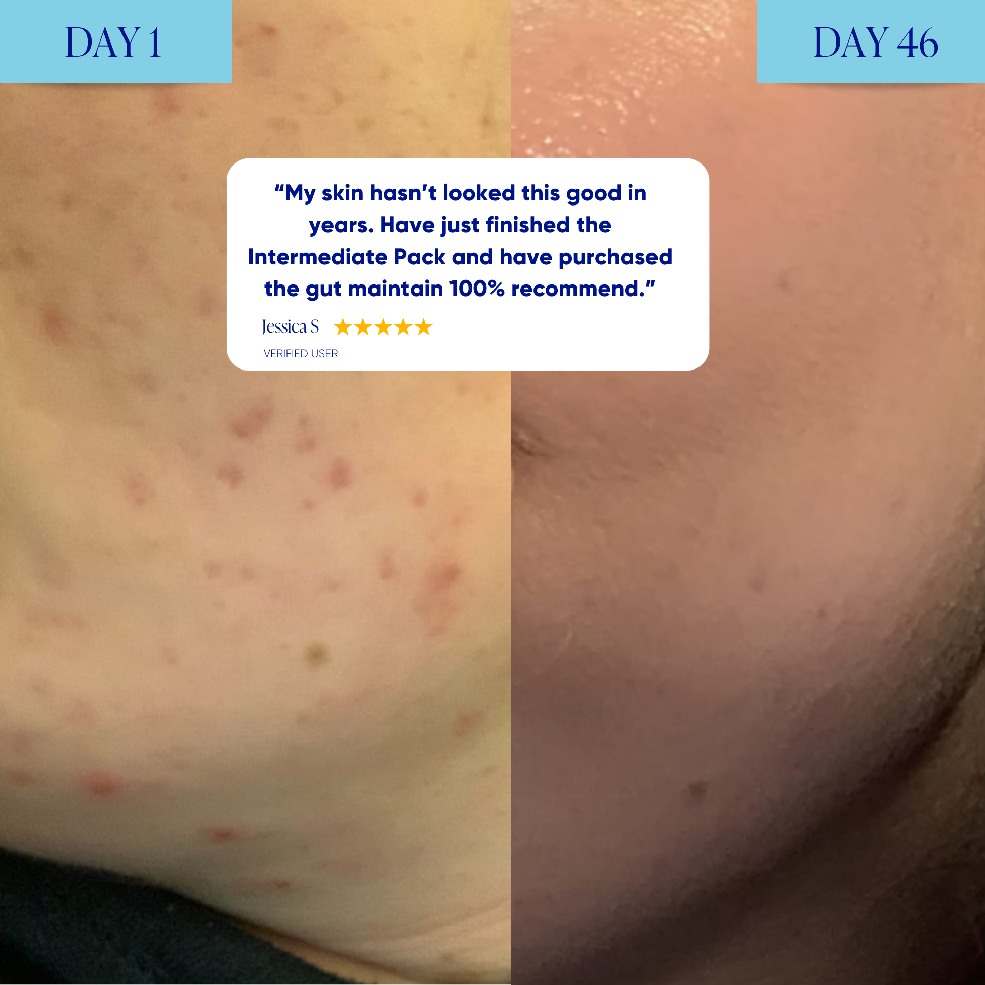 Skin & Gut Maintain™