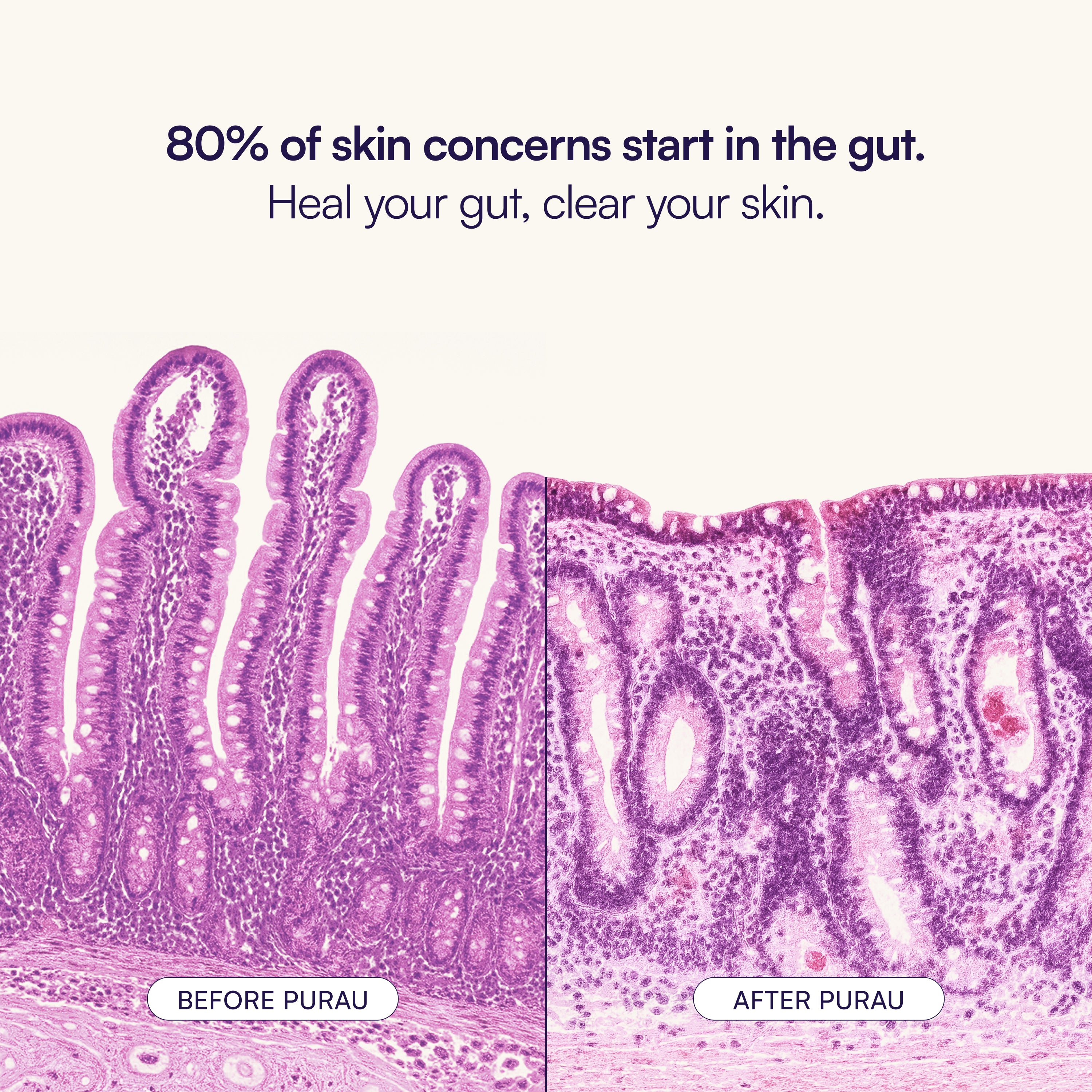 Skin & Gut Program™