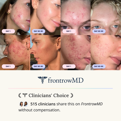 Advanced Acne Program™